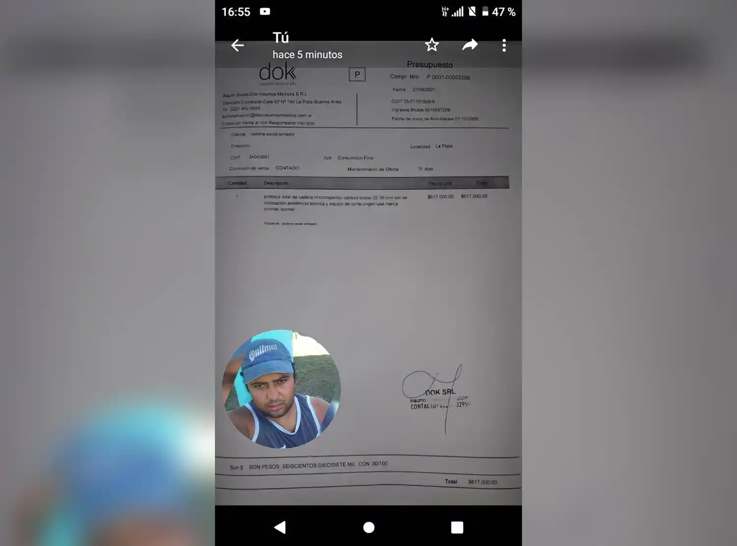 Paulo Carena necesita comprarse una prótesis y pide colaboración a los vecinos