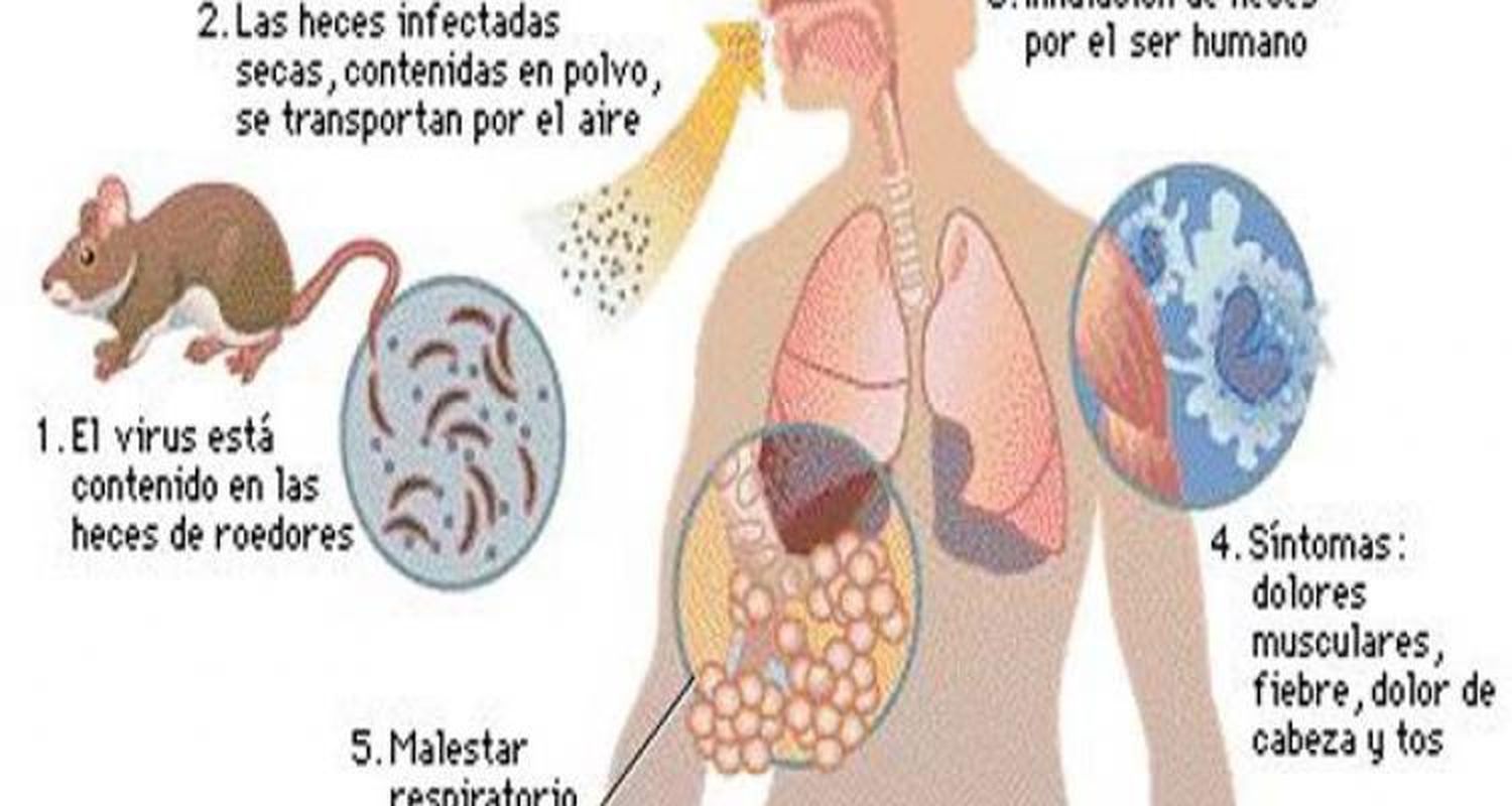 Buscan prevenir enfermedades transmitidas por roedores
