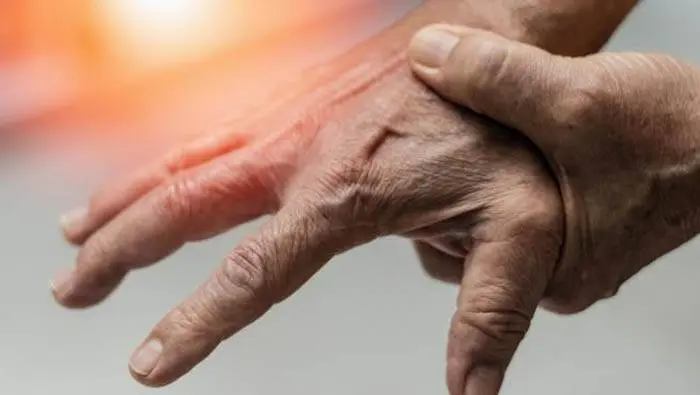Descubren que la combinación  de dos medicamentos puede  revertir la artrosis