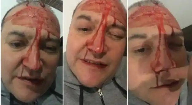 “Me pegaron por ser homosexual”: Leo García fue agredido físicamente