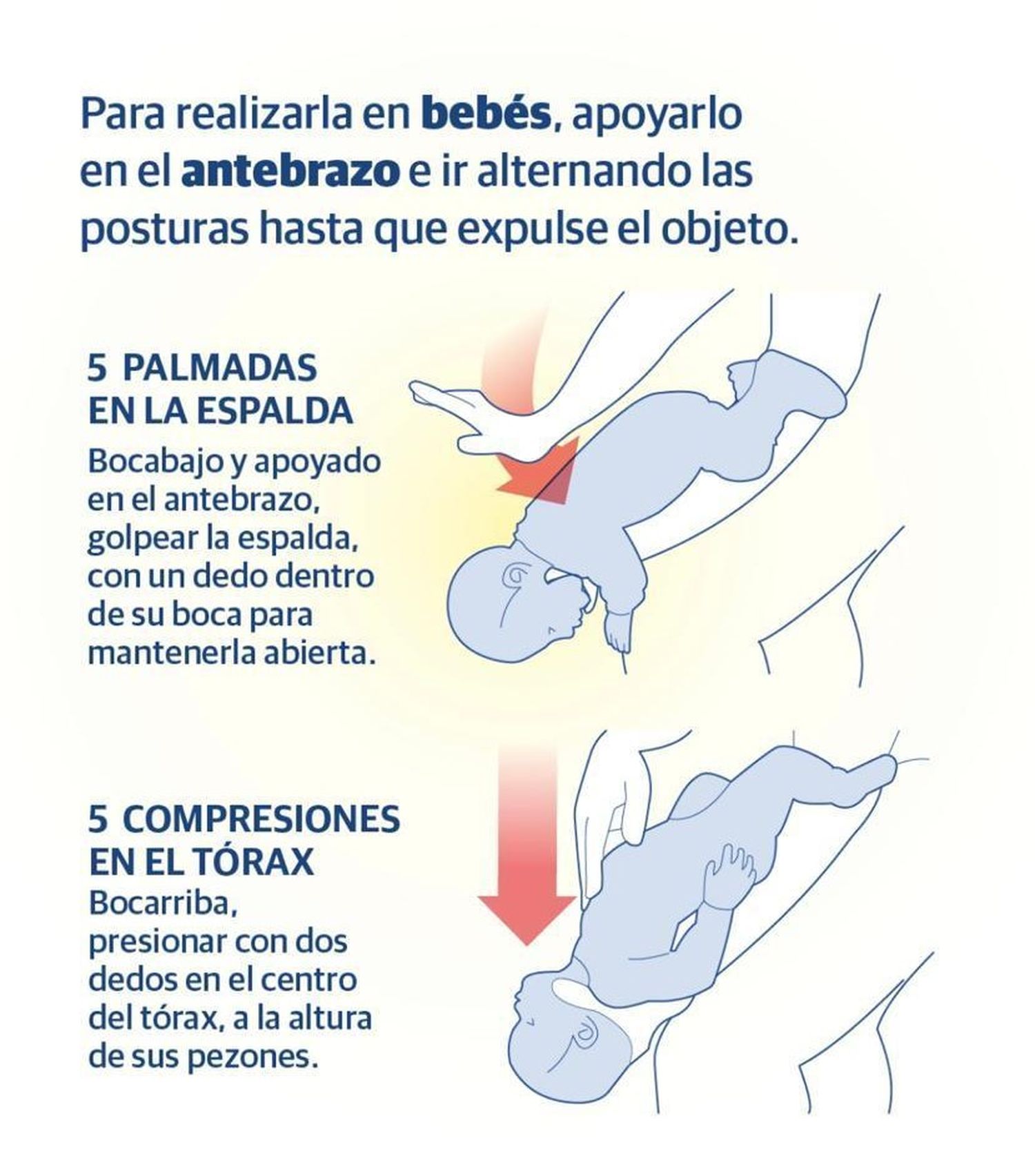 maniobra de Heimlich
