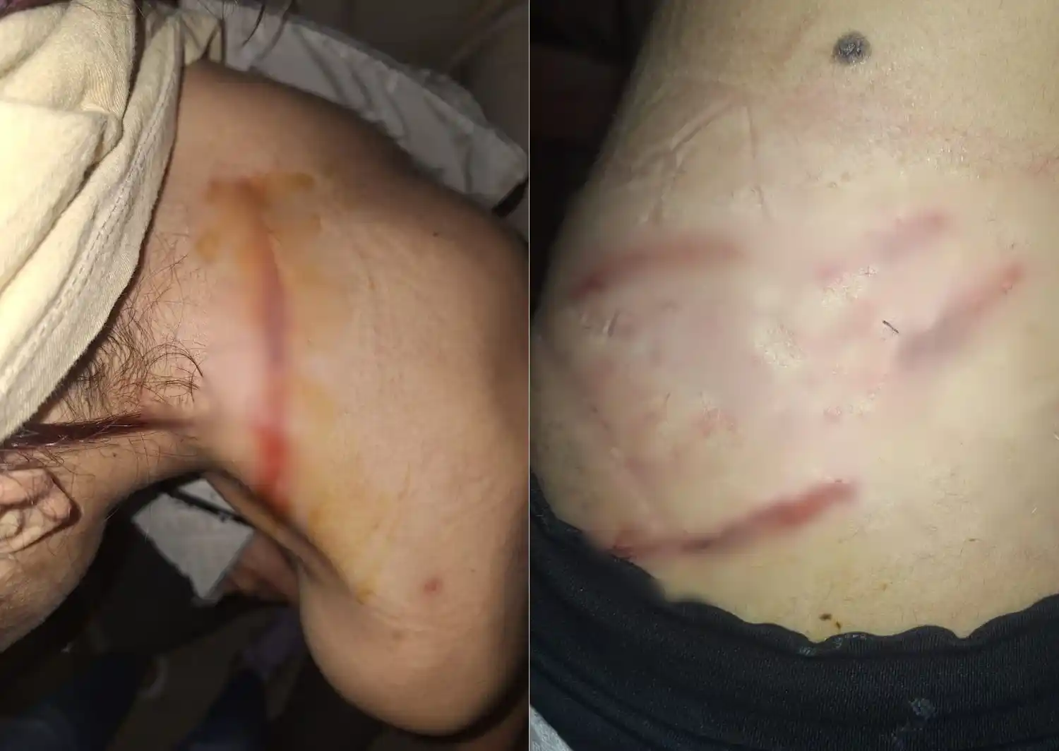Mujer atacada por perros violentos en Bajo Puerto