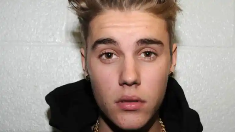 Dictan libertad condicional a Justin Bieber por vandalismo, pero no por acné 
