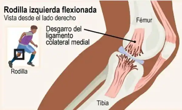 Recomiendan evitar las carreras “virtuales” en espacios reducidos