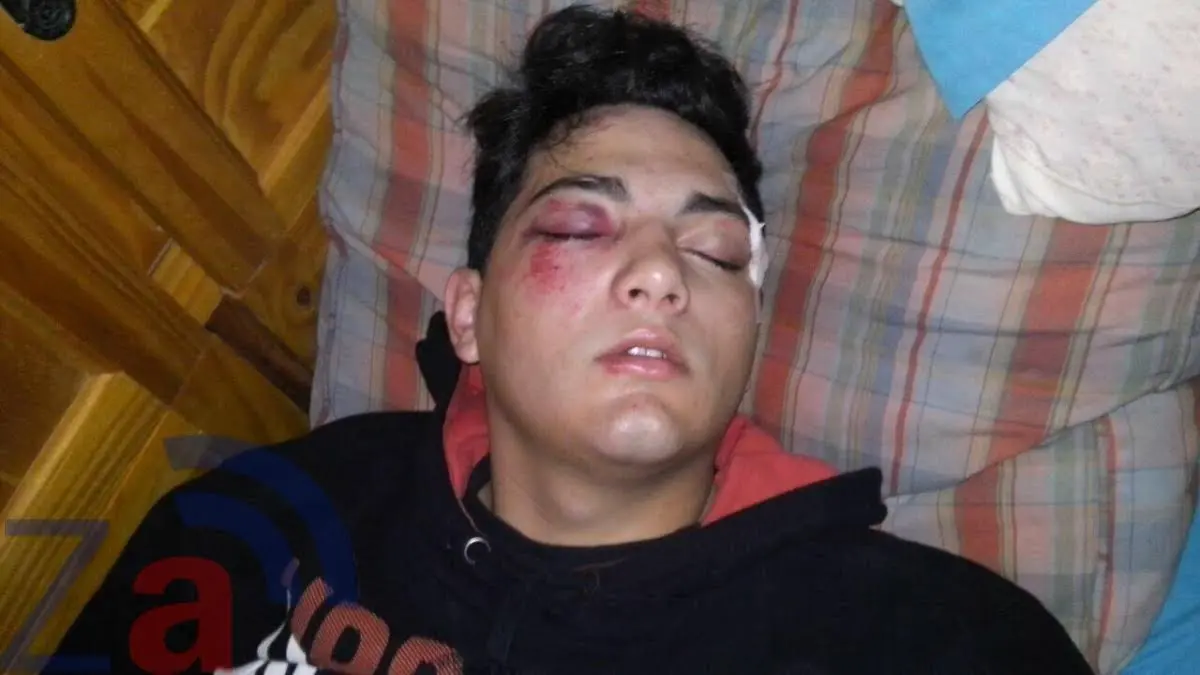 Feroz asalto en Zárate: Desfiguraron a un joven que viajaba en colectivo