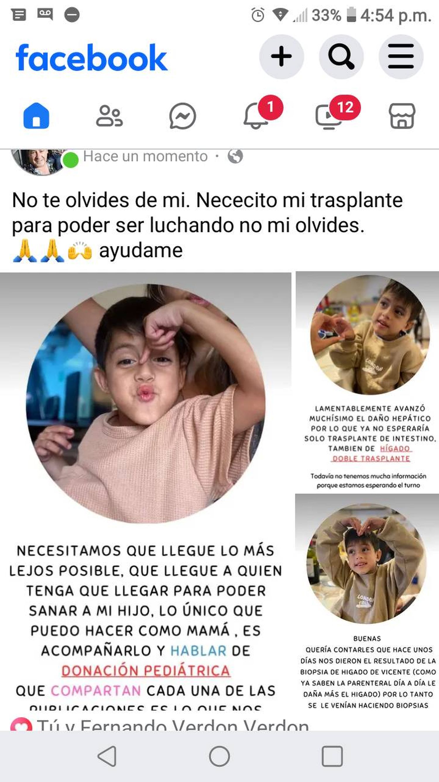 Trasplante de Vicente Budiño Verdón