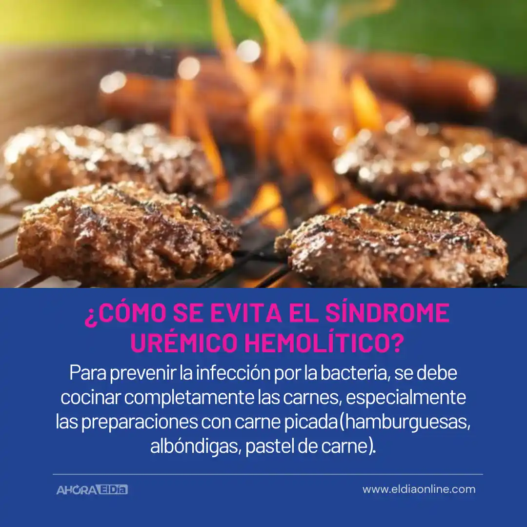 Síndrome Urémico Hemolítico: Cómo prevenir la enfermedad de la “Carne Cruda” - 7
