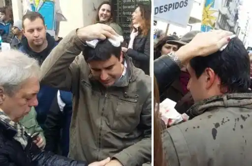 Vallas y represión policial en la visita de Macri a Rosario