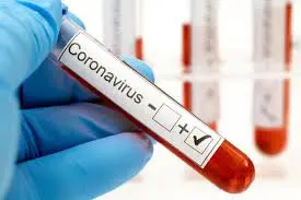 Covid-19: Confirman 8.932 contagios y 68 muertes en las últimas 24 horas
