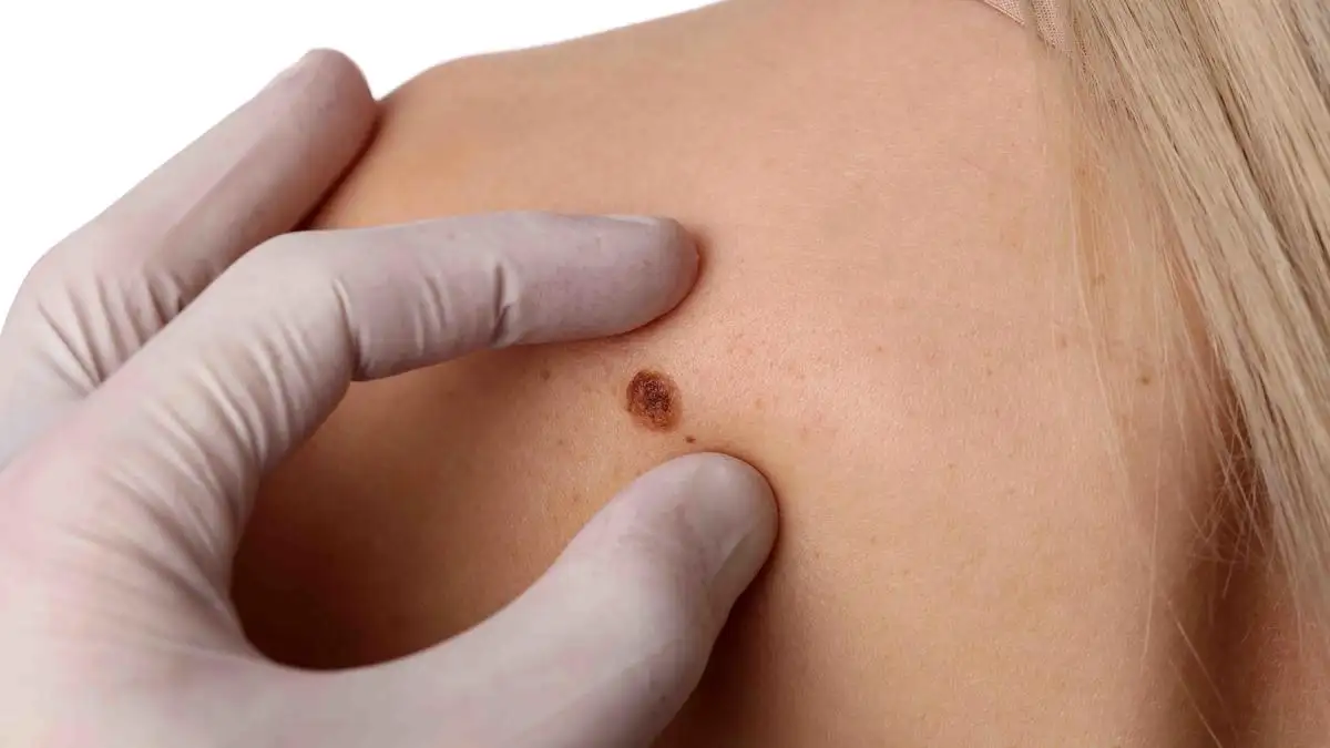 Cuidar la piel en verano: consejos clave para una protección efectiva