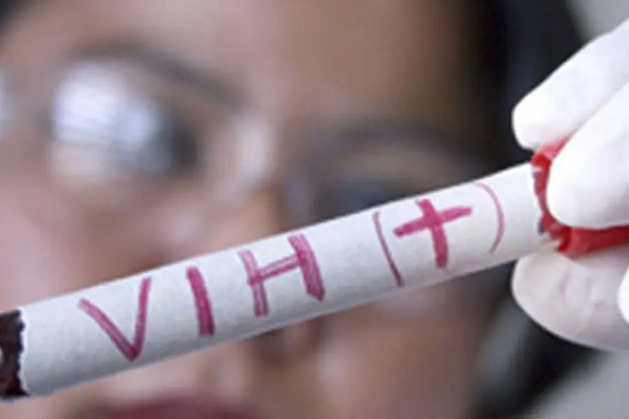 Se registró un nuevo caso de remisión del VIH tras un trasplante de médula ósea