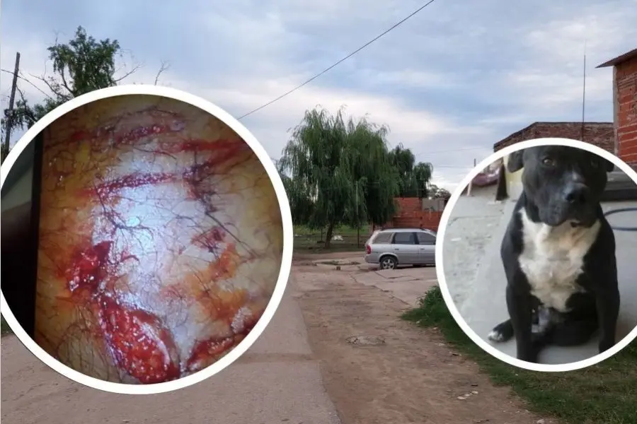 Un pitbull atacó a un policía y debieron matarlo para que lo soltara 