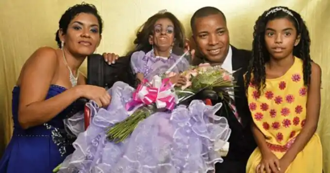 La dura historia de Magalí: Festejó sus 15 años pero parece de 90