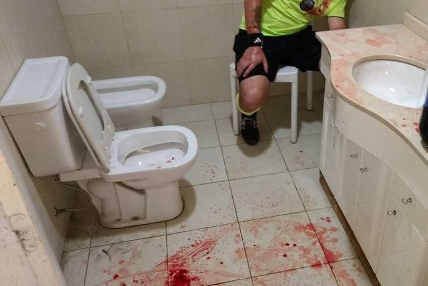 En Pergamino, tres árbitros fueron agredidos brutalmente por hinchas de Juventud