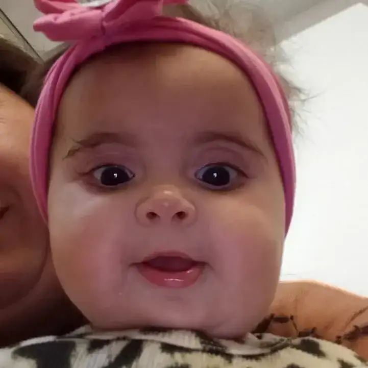 Emma, la beba que pasó por una cirugía inédita en el país, se recupera favorablemente y espera el alta médico