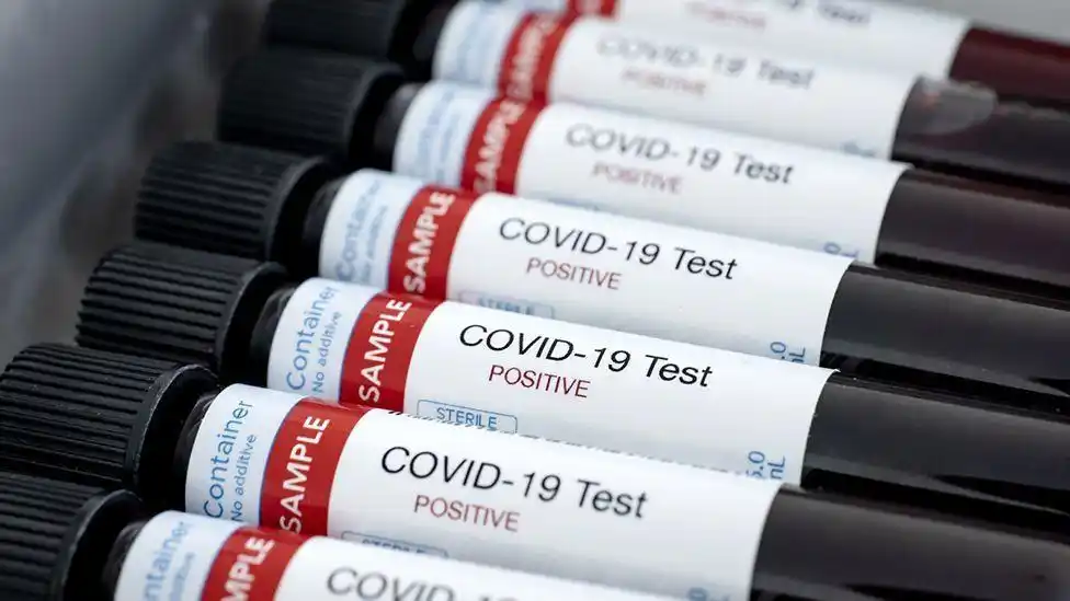 Caso positivo de  coronavirus en Concordia. Es un paciente asintomático que estaba en cuarentena