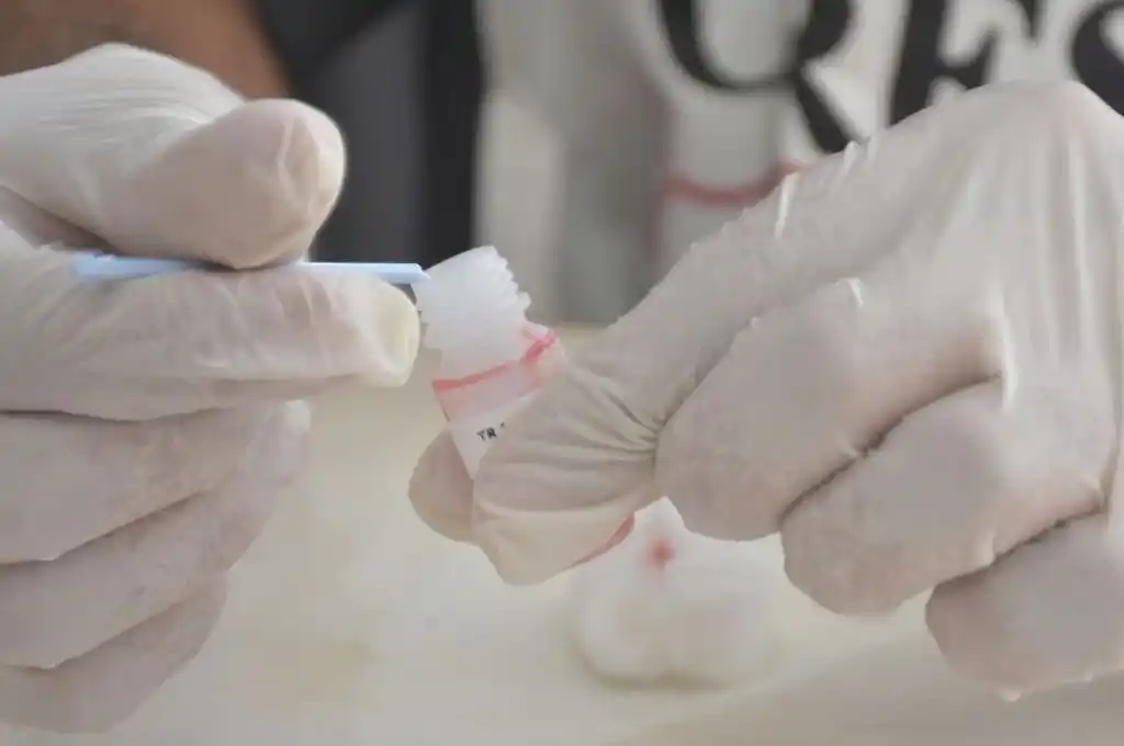 Día Mundial de Lucha contra el Sida