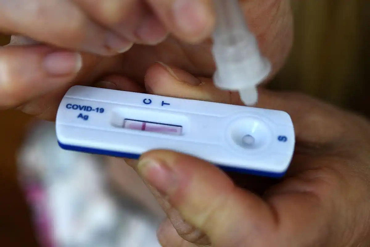 Advierten que habrá demoras en la llegada de los autotest