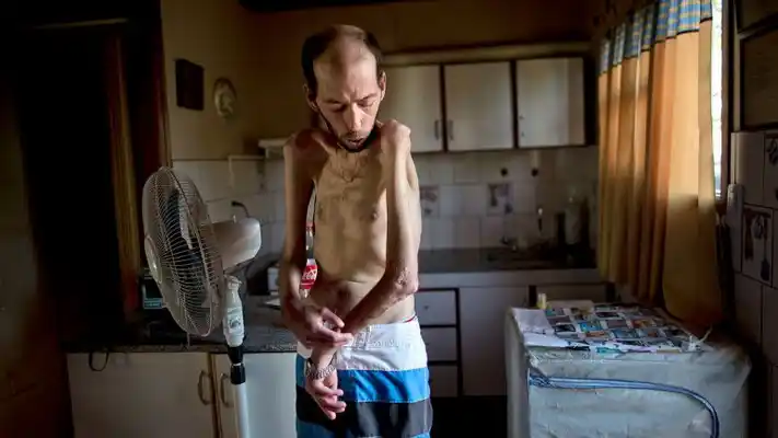 Agroquímicos: entre la preocupación y el impacto en la salud