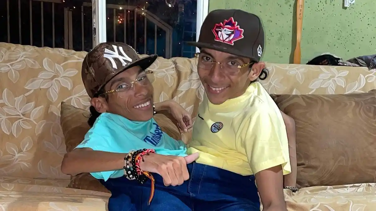El último adiós a José Luis y José Armando, los gemelos siameses que conmovieron al mundo