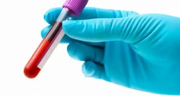 Reactivos contra el HIV