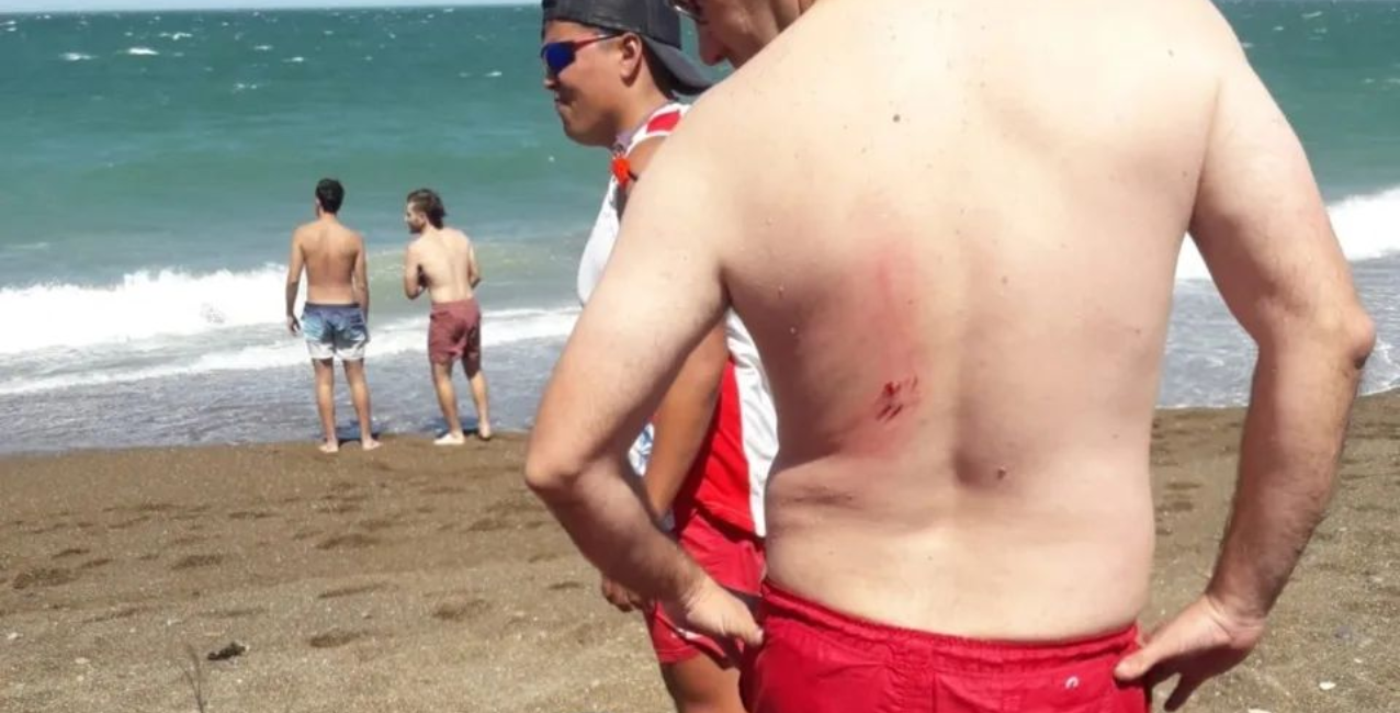 Chubut: un lobo marino atacó a un bañista en Playa Unión
