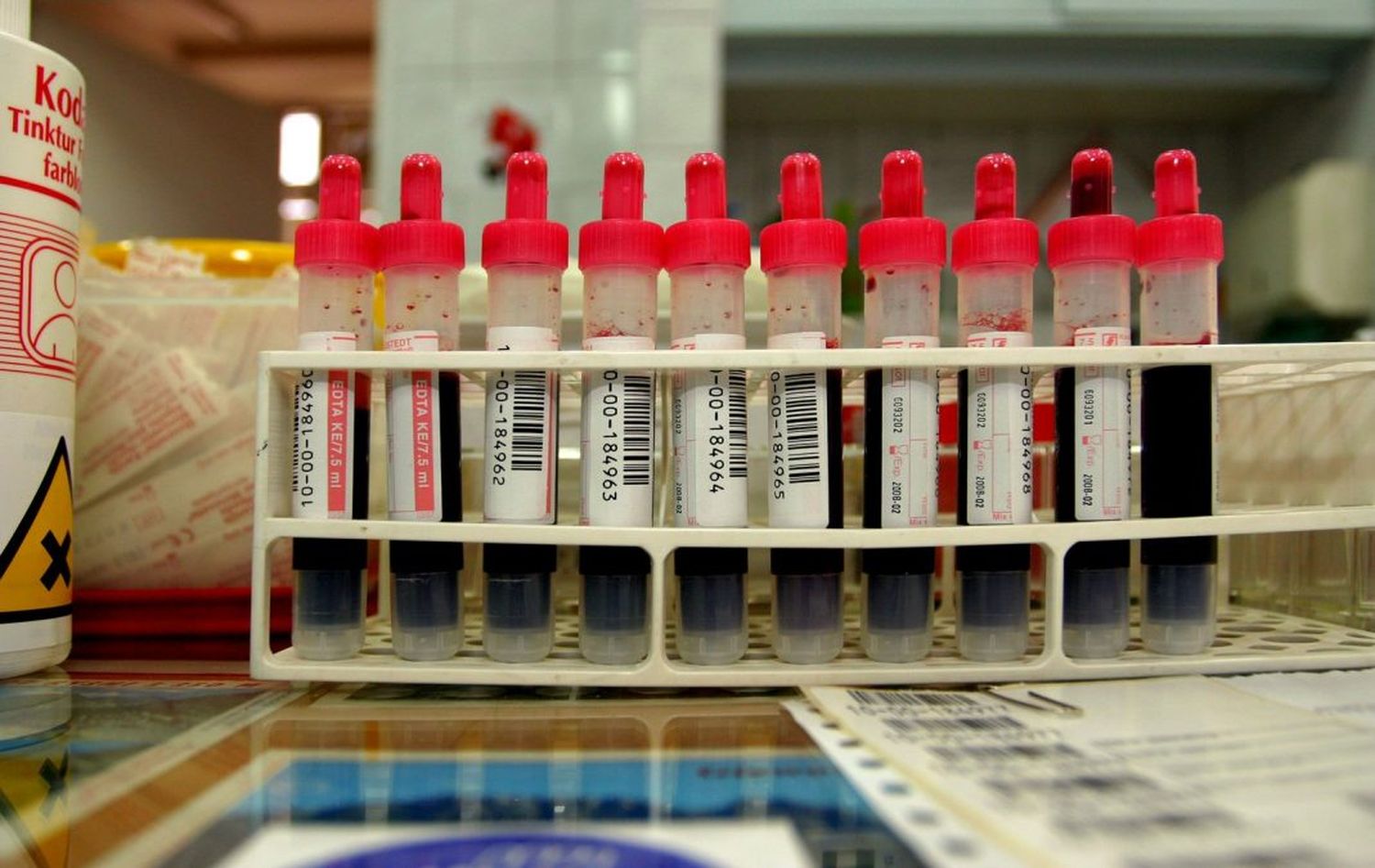 Hasta donde llega el hambre: venden su sangre para sobrevivir en Venezuela