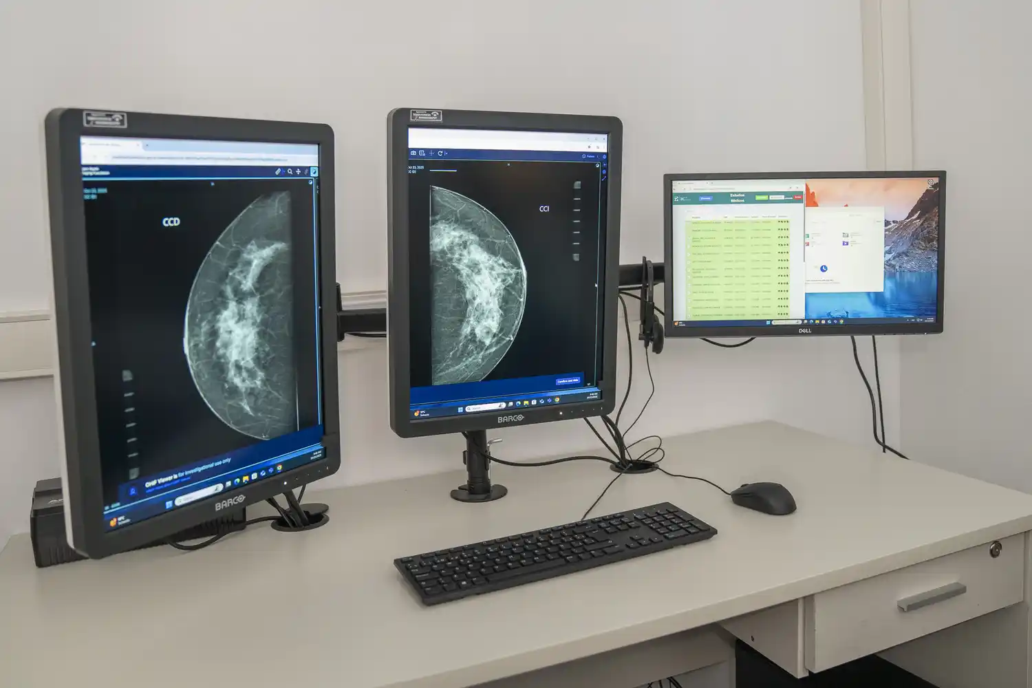 La provincia comenzó a realizar la lectura e informes de las mamografías de forma centralizada