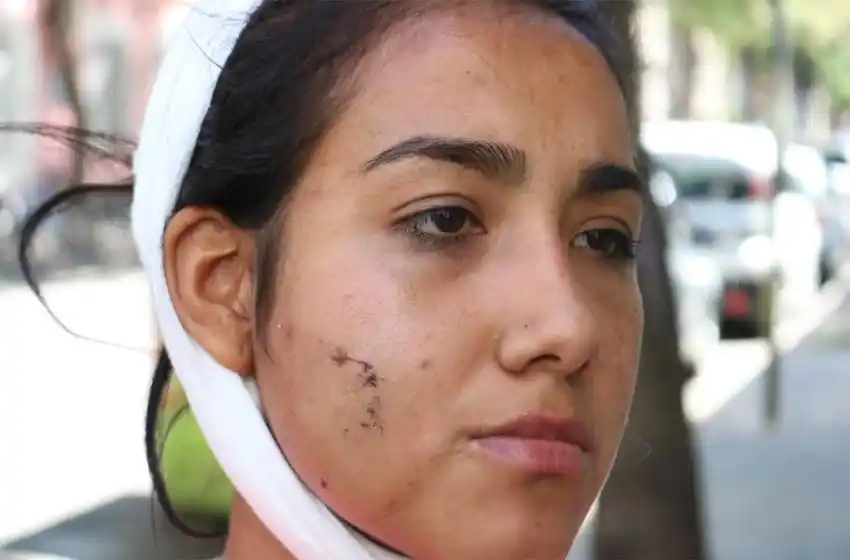 «Los dueños del boliche se lavaron las manos», aseguró el papá de la chica atacada por una patota en Arroyo Seco