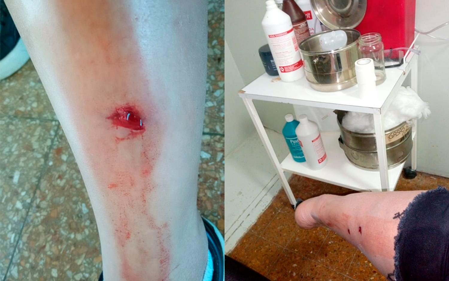 Perros mordieron a motociclista frente al Paseo Público