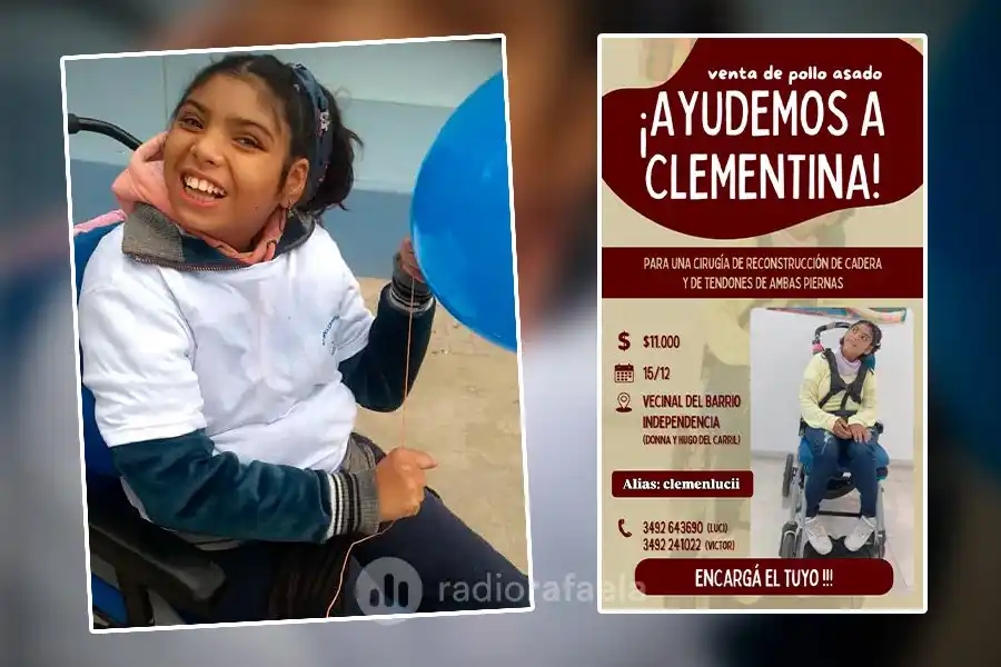 Ayudemos a Clementina: sufre de microcefalia congénita y lanzó una venta de pollos para pagar una costosa cirugía