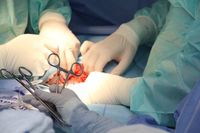 La donación de órganos aumentó un 30% en el primer cuatrimestre del año