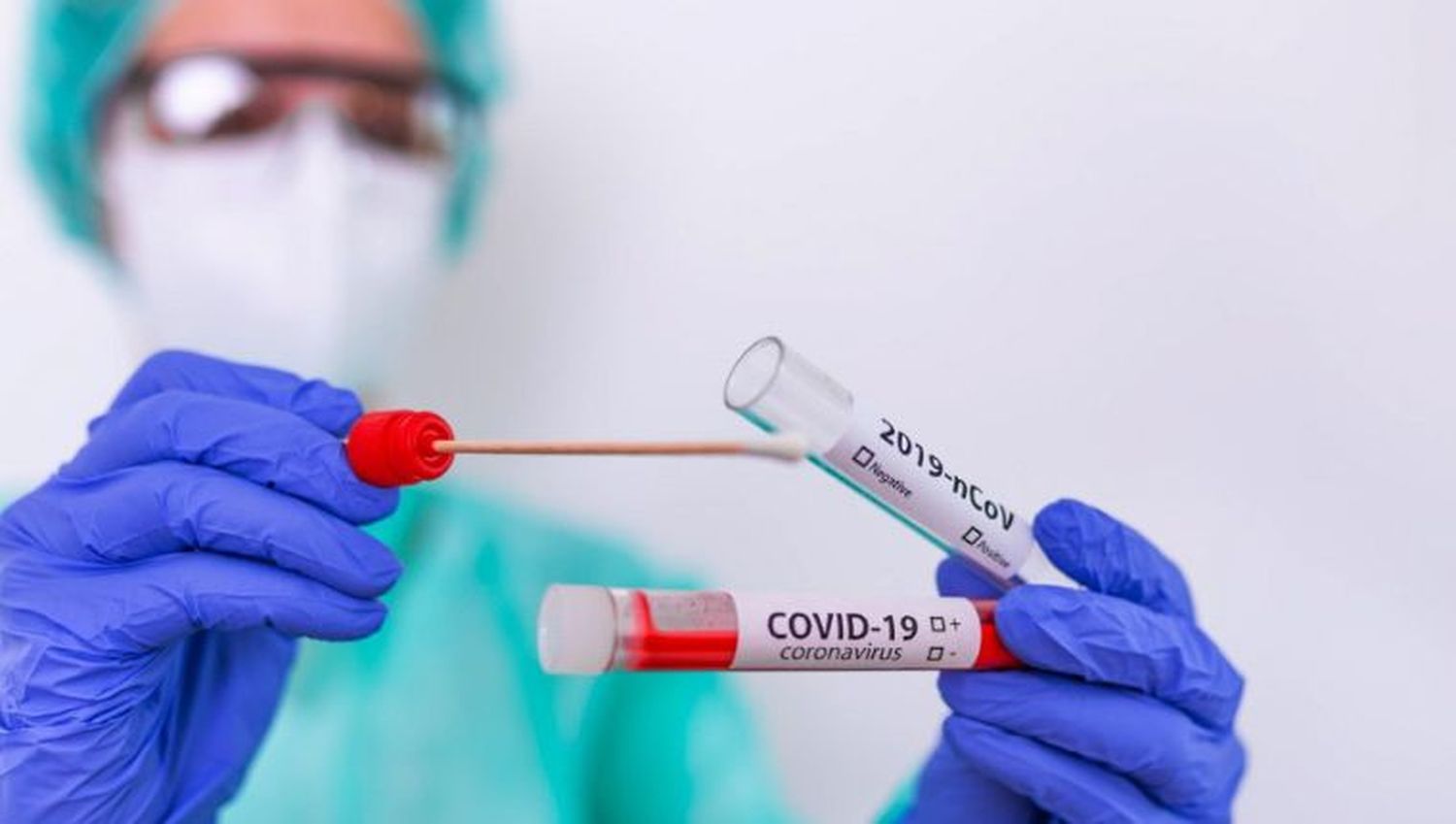 ¡PREOCUPADOS! Bionalistas instan a descentralizar las pruebas PCR
