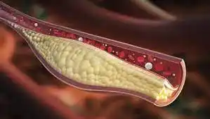 Estos son los 12 mejores alimentos para DESTAPAR LAS ARTERIAS