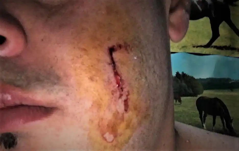Bajó de la moto, intentó apuñalarlo y lo cortó en la cara: todo porque “lo miró” al pasar por la calle