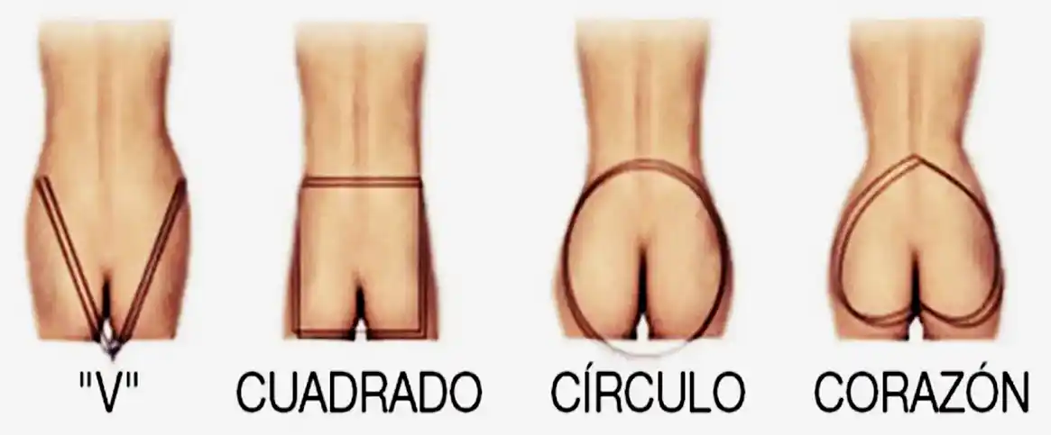 Aumento de Glúteos Hibrido
