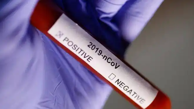 Concordia sumó 98 nuevos casos de coronavirus