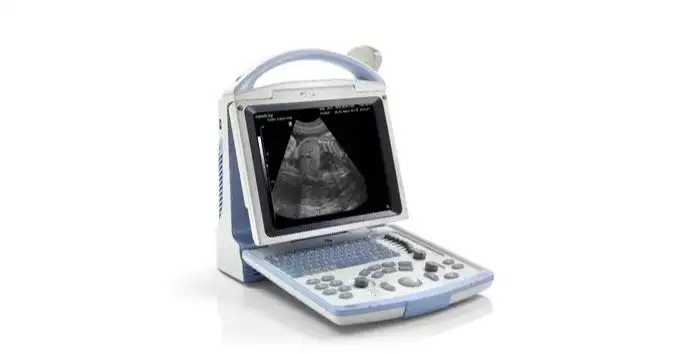 ¿Cuánto cuesta el ecógrafo que robaron del Hospital Centenario?