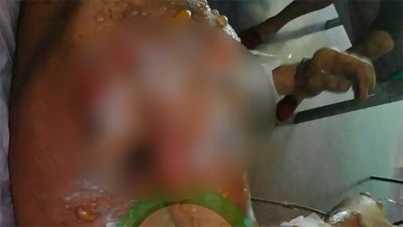 Entre Ríos: Denuncian que prendieron fuego a un detenido