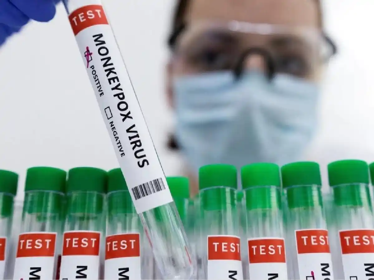 La OMS confirmó 780 casos de viruela del mono en 27 países donde el virus no es endémico