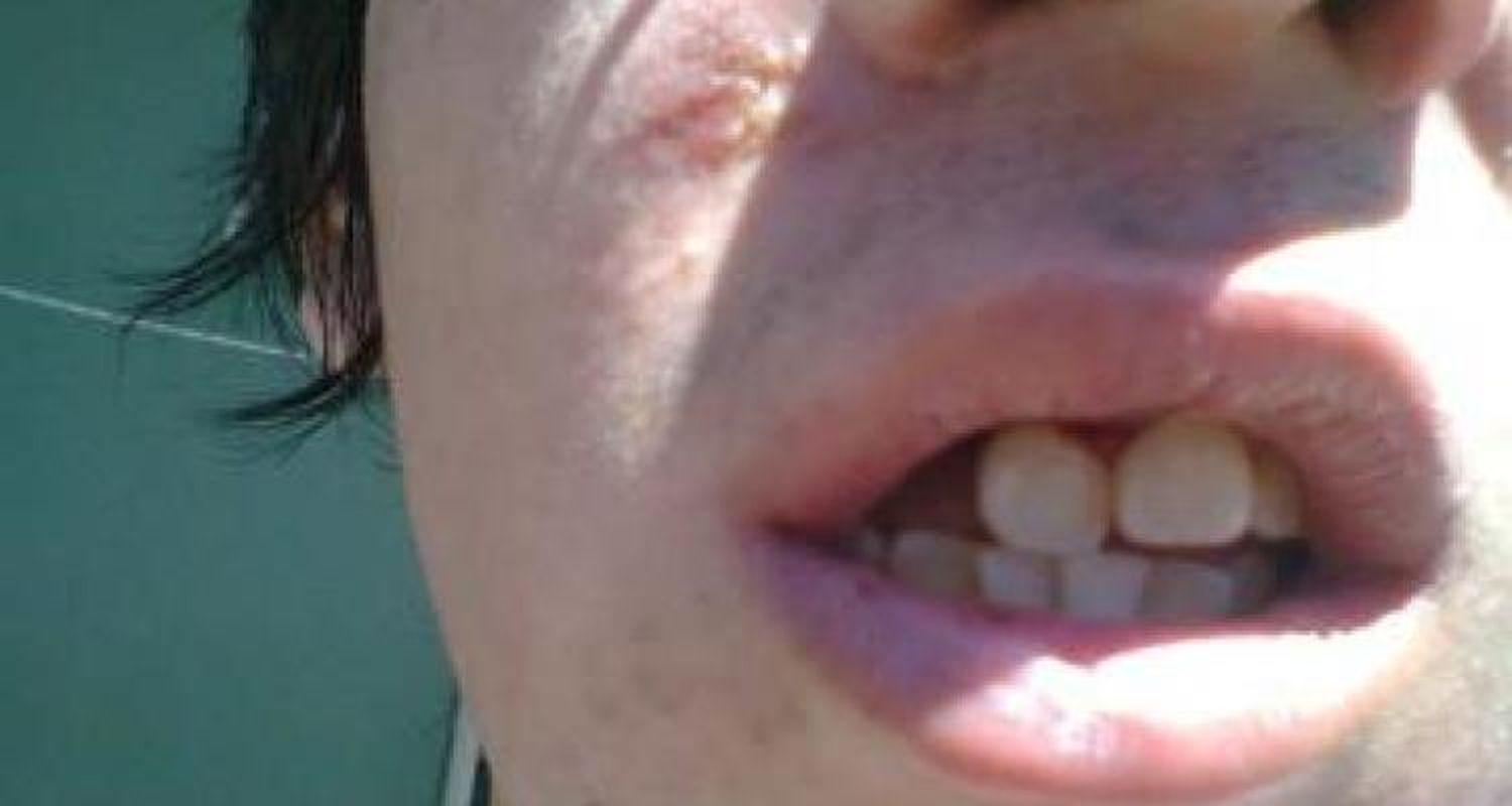 Joven que golpeó a otro en la Escuela Industrial dijo que “fue en defensa propia”