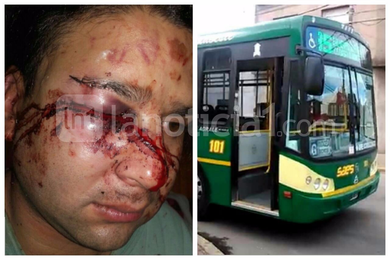 Otro ataque a un colectivero: Ahora desfiguraron a un chofer de la línea 85 en Quilmes