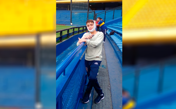 Alex, el niño mordido por un pitbull, se recupera y este fin de semana organizan una pollada