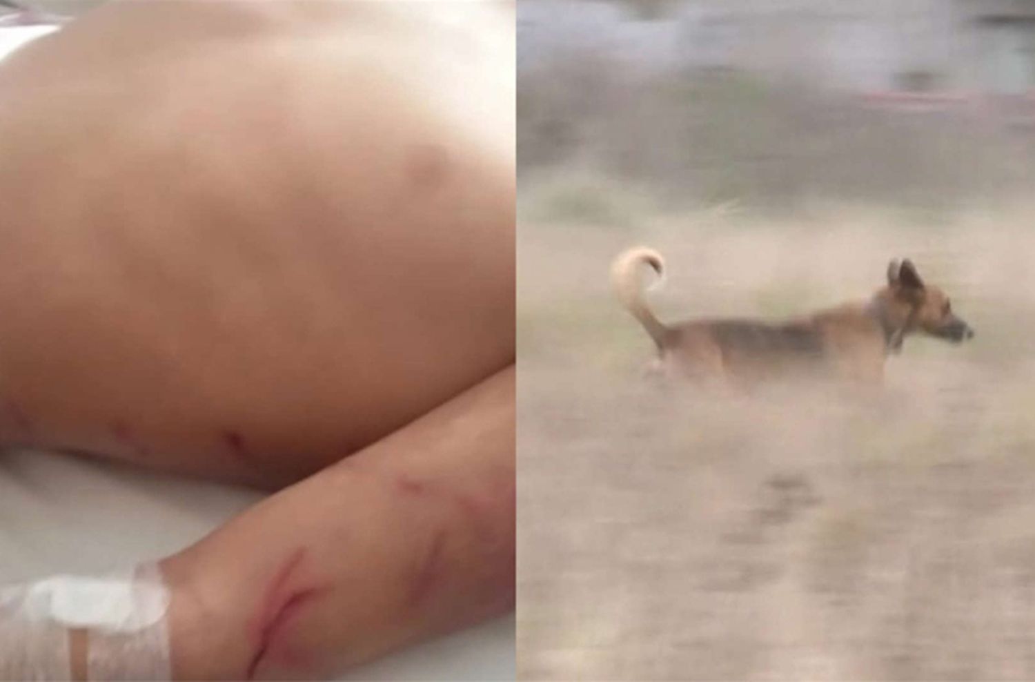 Un nene de 9 años fue atacado por 16 perros: de milagro está fuera de peligro