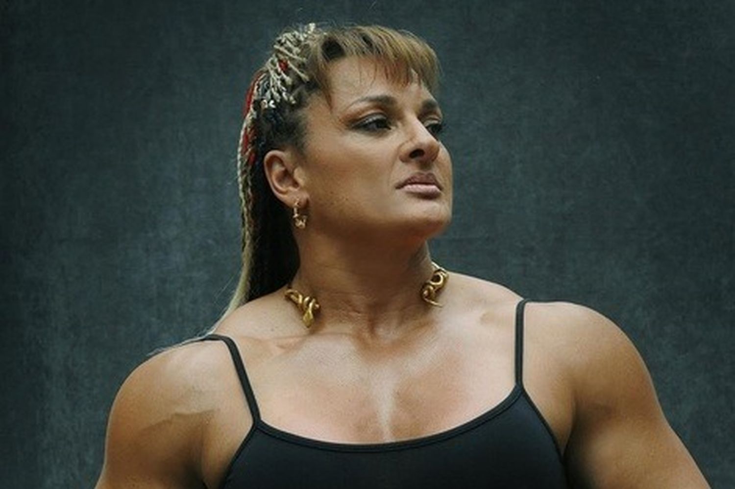 La "Locomotora" Oliveras debió ser operada de urgencia con un cuadro neurológico delicado