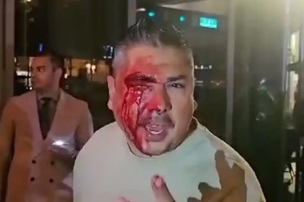 El hombre denunció la brutal agresión que sufrió por un malentendido