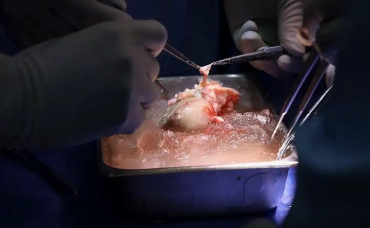 El riñón de cerdo en hielo, a la espera de ser trasplantado a Slayman en el Hospital General de Massachusetts.