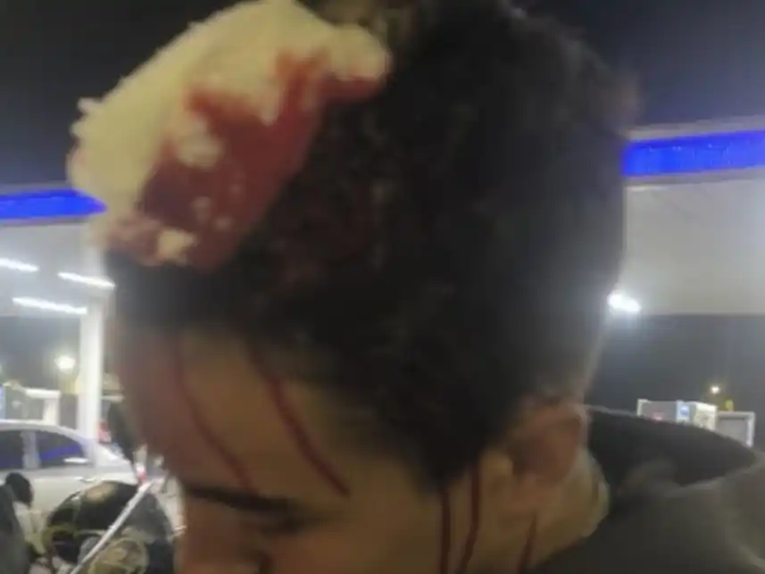 Uno de los heridos durante el incidente donde se vieron involucrados los marplatenses.