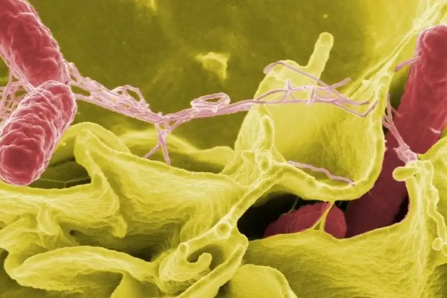 tuberculosis