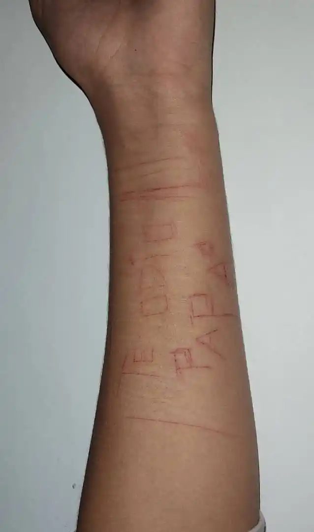 «TE ODIO PAPÁ» la expresión que joven se tatúa tras abuso de su progenitor